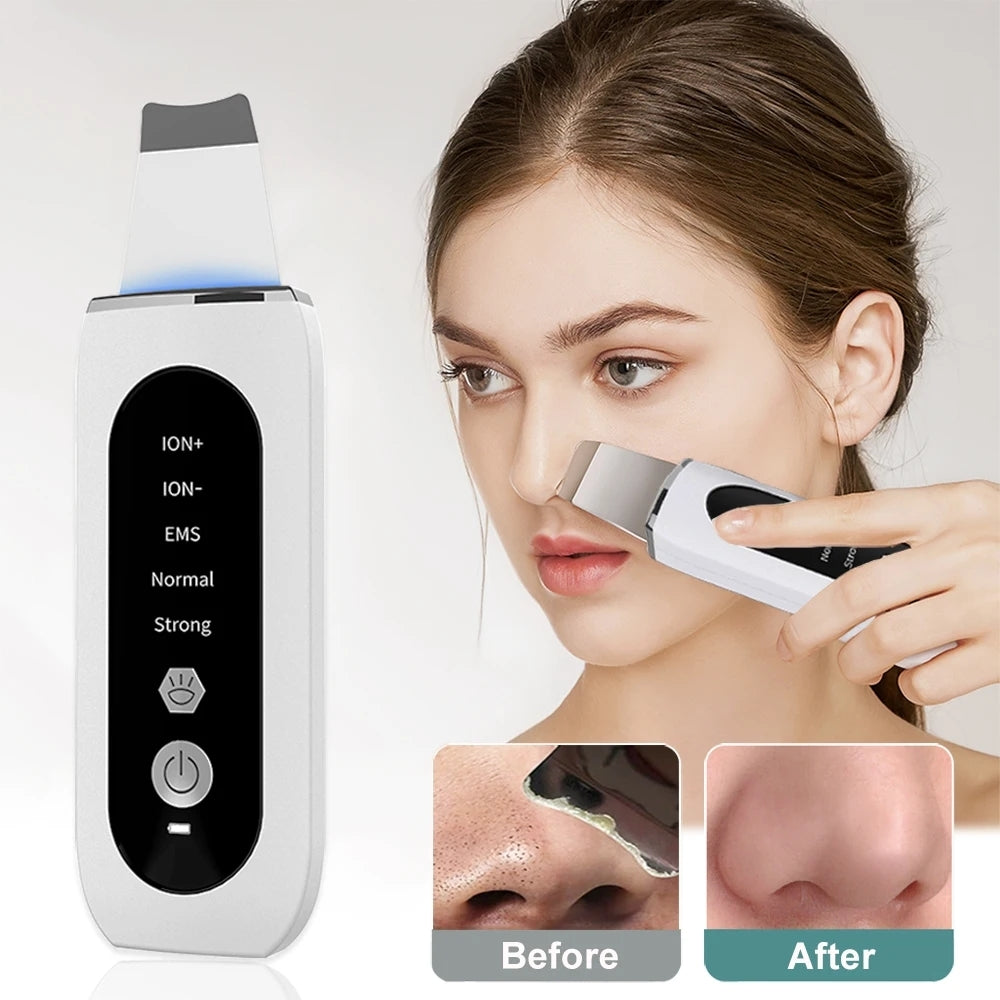 LINO Ultrasonic Skin Scrubber – LinoShine